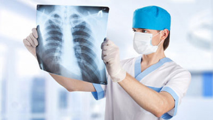 Флюорографическое обследование – главный способ диагностики туберкулеза